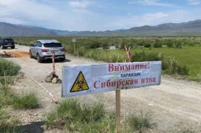 сибирская язва